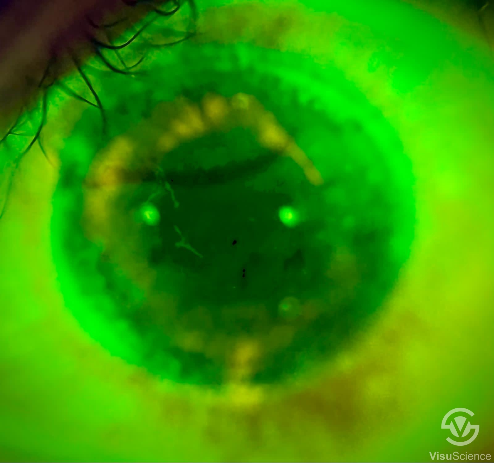 Smartphone Eye Imaging Adapter Products VisuScience