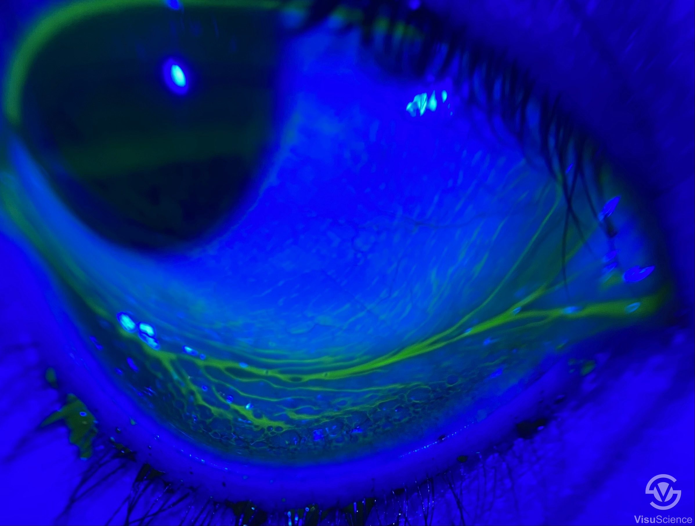 Cordelia fajance i dag Smartphone Eye Imaging Adapter - Products - VisuScience
